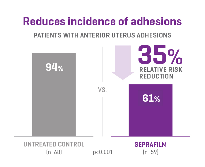 Graph showing 35% adhesion rate reduction in Seprafilm users